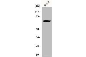 Western Blot analysis of HepG2 cells using MMP-16 Polyclonal Antibody