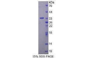 SDS-PAGE analysis of Human ANTXR2 Protein. (ANTXR2 Protein)
