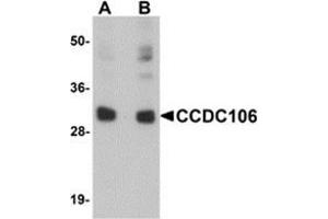 Western blot analysis of CCDC106 in human brain tissue lysate with CCDC106 antibody at (A) 0. (CCDC106 antibody  (C-Term))