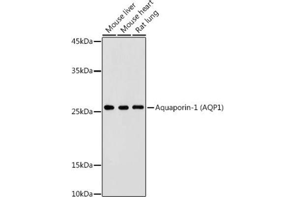 Aquaporin 1 antibody  (C-Term)