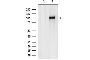 anti-Protein Phosphatase 1, Regulatory Subunit 13B (PPP1R13B) (Internal Region) antibody