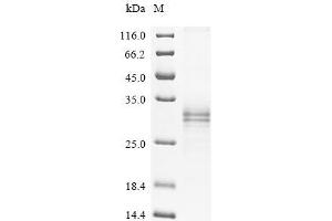 Alpha-2A Adrenergic Receptor (ADRA2A) (AA 233-389) protein (His tag)