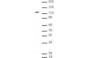 SIRT1 mAb (Clone 2G1/F7) tested by Western blot. (SIRT1 antibody  (AA 581-630))