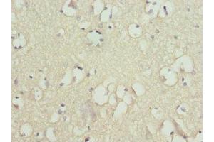 Immunohistochemistry of paraffin-embedded human brain tissue using ABIN7170056 at dilution of 1:100 (FXYD2 antibody  (AA 1-64))