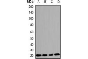 Western blot analysis of COX4-2 expression in A549 (A), K562 (B), mouse lung (C), rat lung (D) whole cell lysates. (COX4I2 antibody)