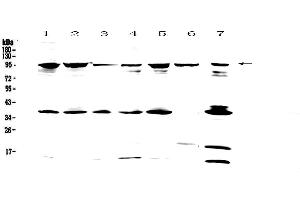 Western blot analysis of FES using anti-FES antibody . (FES antibody)