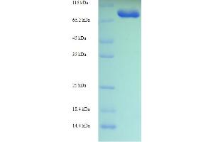 SDS-PAGE (SDS) image for Glycerol Kinase 2 (GK2) (AA 2-553), (partial) protein (His-SUMO Tag) (ABIN5709579)