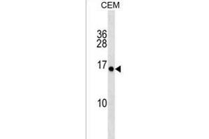 PLGLA Antibody (N-term) (ABIN1539205 and ABIN2850410) western blot analysis in CEM cell line lysates (35 μg/lane). (PLGLA antibody  (N-Term))