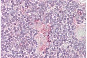 Anti-LYN antibody IHC staining of human thymus.