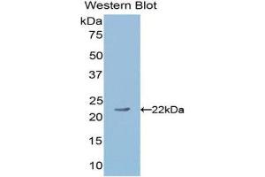 Western Blotting (WB) image for anti-Angiopoietin 1 (ANGPT1) (AA 253-429) antibody (ABIN3209769) (Angiopoietin 1 antibody  (AA 253-429))