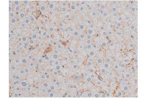 ABIN6255699 and ABIN6267466 at 1/200 staining Rat liver tissue sections by IHC-P.