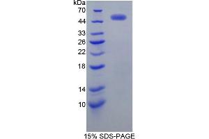 SDS-PAGE of Protein Standard from the Kit  (Highly purified E. (ErbB2/Her2 ELISA Kit)