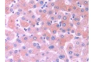 Detection of MOSC1 in Human Liver Tissue using Polyclonal Antibody to MOCO Sulphurase C-Terminal Domain Containing Protein 1 (MOSC1) (MOSC1 antibody  (AA 41-335))