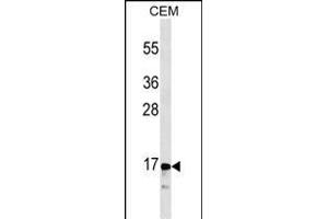 CALCA/CT Antibody (ABIN1536609 and ABIN2843838) western blot analysis in CEM cell line lysates (35 μg/lane). (Calcitonin antibody  (AA 56-84))