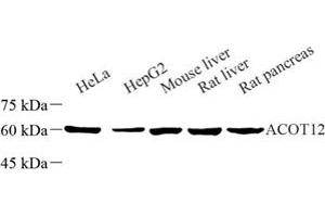 ACOT12 antibody