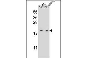 LSM7 Antibody (C-term) (ABIN655625 and ABIN2845104) western blot analysis in CEM cell line and mouse spleen tissue lysates (35 μg/lane).