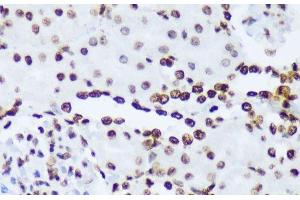 Immunohistochemistry of paraffin-embedded Rat kidney using Phospho-ABL1(Y245) Polyclonal Antibody at dilution of 1:100 (40x lens). (ABL1 antibody  (pTyr245))