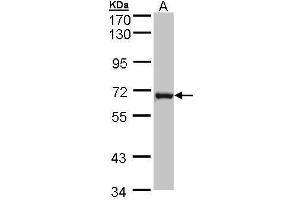 WB Image Sample (30 ug of whole cell lysate) A: MOLT4 , 7. (DENND1B antibody  (Center))