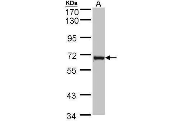 DENND1B antibody  (Center)