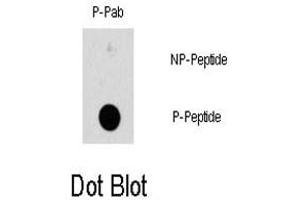Dot blot analysis of HSPB1 (phospho S78) polyclonal antibody  on nitrocellulose membrane. (HSP27 antibody  (pSer78))