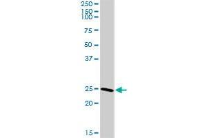 CLTB MaxPab rabbit polyclonal antibody. (CLTB antibody  (AA 1-211))