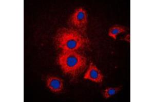 Immunofluorescent analysis of Cytokeratin 19 staining in MCF7 cells. (Cytokeratin 19 antibody  (Center))