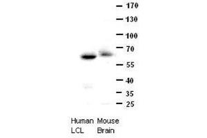 CCT8 antibody - C-terminal region  validated by WB using human lymphoblastoid & mouse brain
