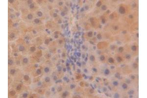 DAB staining on IHC-P; Samples: Rat Liver Tissue (SOD1 antibody  (AA 2-154))
