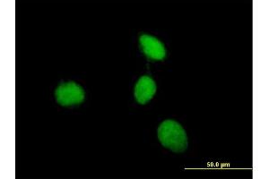 Immunofluorescence of purified MaxPab antibody to MEN1 on HeLa cell. (Menin antibody  (AA 1-575))