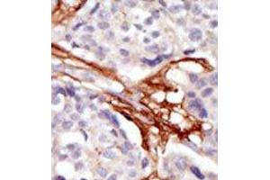 Image no. 2 for anti-V-Yes-1 Yamaguchi Sarcoma Viral Oncogene Homolog 1 (YES1) (N-Term) antibody (ABIN360002)