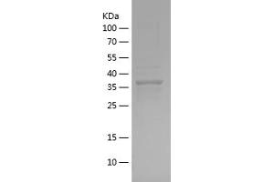 Afamin Protein (AFM) (AA 22-143) (His-IF2DI Tag)