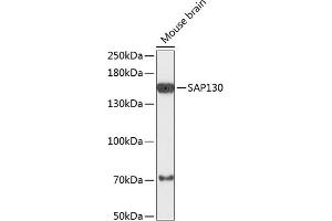 Western blot analysis of extracts of mouse brain, using S antibody (ABIN6132628, ABIN6147370, ABIN6147372 and ABIN6218063) at 1:3000 dilution.