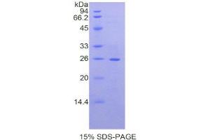 SDS-PAGE (SDS) image for Laminin, beta 2 (Laminin S) (LAMB2) (AA 1498-1716) protein (His tag) (ABIN2121523) (LAMB2 Protein (AA 1498-1716) (His tag))