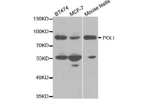 Western blot analysis of extracts of various cell lines, using POLI antibody. (POLI antibody  (AA 50-350))