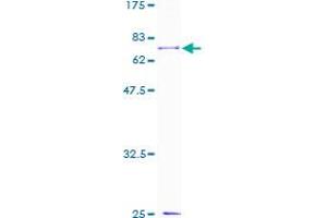 Image no. 1 for Transforming Growth Factor beta 1 Induced Transcript 1 (TGFB1I1) (AA 1-444) protein (GST tag) (ABIN1322604)