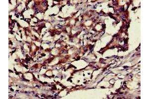 Immunohistochemistry (IHC) image for anti-High Mobility Group Box 1 (HMGB1) (AA 2-215) antibody (ABIN7155201)