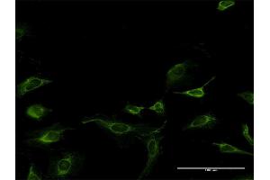 Immunofluorescence of monoclonal antibody to MAGOH on HeLa cell.