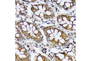Immunohistochemistry of paraffin-embedded human colon using p70 S6 Kinase 2 Rabbit mAb (ABIN7270034) at dilution of 1:100 (40x lens). (RPS6KB2 antibody)