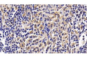 Immunohistochemistry (IHC) image for anti-ATG16 Autophagy Related 16-Like 1 (ATG16L1) (AA 342-607) antibody (ABIN7443884)