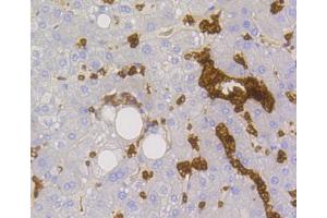 Immunohistochemistry of paraffin-embedded human liver using SLC2A1 antibody (ABIN5997113) at dilution of 1/100 (40x lens).