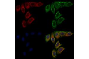 ABIN6263792 and ABIN6277681 staining Hela cells by IF/ICC. (OCA2 antibody  (N-Term))
