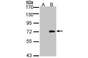 WB Image Western Blot analysis of ULK4 expression in transfected 293T cell line by ULK4 polyclonal antibody. (ULK4 antibody  (Internal Region))
