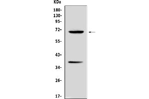 Western blot analysis of Alpha 1 Fetoprotein using anti-Alpha 1 Fetoprotein antibody (ABIN5692976).