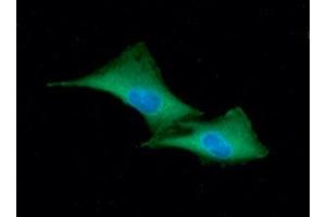 ICC/IF analysis of GSTP1 in A549 cells line, stained with DAPI (Blue) for nucleus staining and monoclonal anti-human GSTP1 antibody (1:100) with goat anti-mouse IgG-Alexa fluor 488 conjugate (Green) (GSTP1 antibody  (AA 1-210))