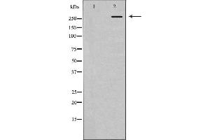 Western blot analysis of extracts of HeLa, using POLR2A antibody. (POLR2A/RPB1 antibody  (Internal Region))