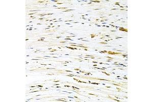 Immunohistochemistry (IHC) image for anti-Mdm2, p53 E3 Ubiquitin Protein Ligase Homolog (Mouse) (MDM2) (AA 130-230) antibody (ABIN3020951)