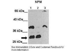 Lanes:   Lane 1: 25ug MIA PaCa-2 cell lysate Lane 2: 25ug MDA-MB-231 cell lysate Lane 3: 25ug Huh-7 cell lysate  Primary Antibody Dilution:   1:2000  Secondary Antibody:   Anti-rabbit-HRP  Secondary Antibody Dilution:   1:5000  Gene Name:   NPM1  Submitted by:   Andrei L.