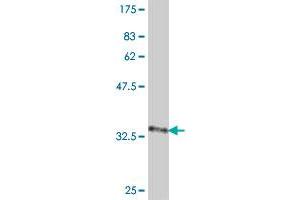 Western Blot detection against Immunogen (37 KDa) . (DCI antibody  (AA 204-302))