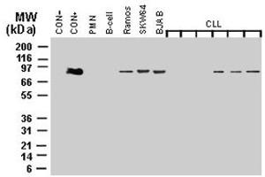 Western blot analysis of MALT1 expression. (MALT1 antibody)