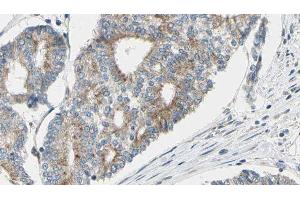 ABIN6277125 at 1/100 staining Human prostate tissue by IHC-P. (GAS2L1 antibody  (C-Term))